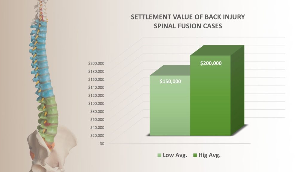 Back Injury Settlements