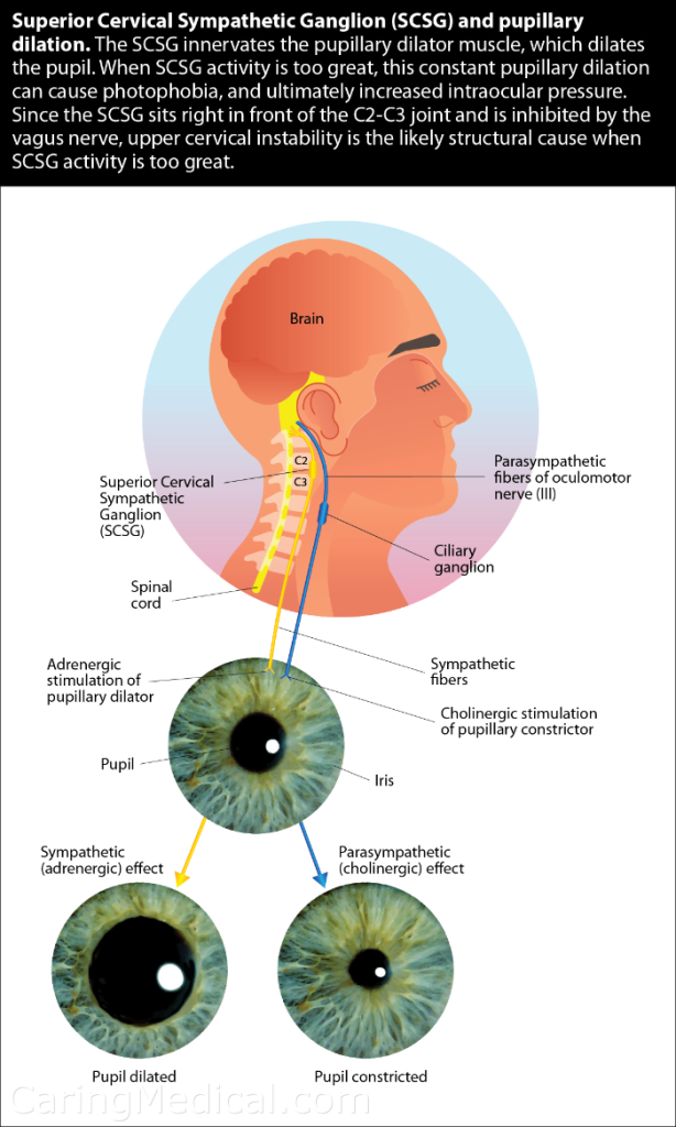 SCSG pupillary dilation WEB