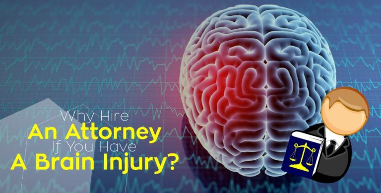 What Happens When You Hire A Brain Injury Lawyer?