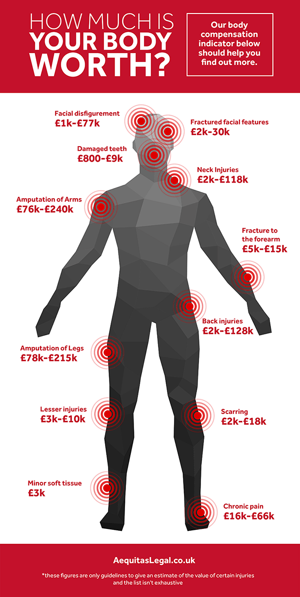 How Much Injury Compensation Will I Get?