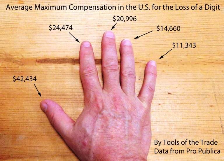 How Much Compensation For A Finger Injury?