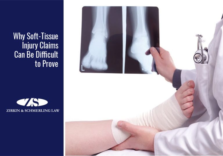 What Is A Soft Tissue Injury Claim?