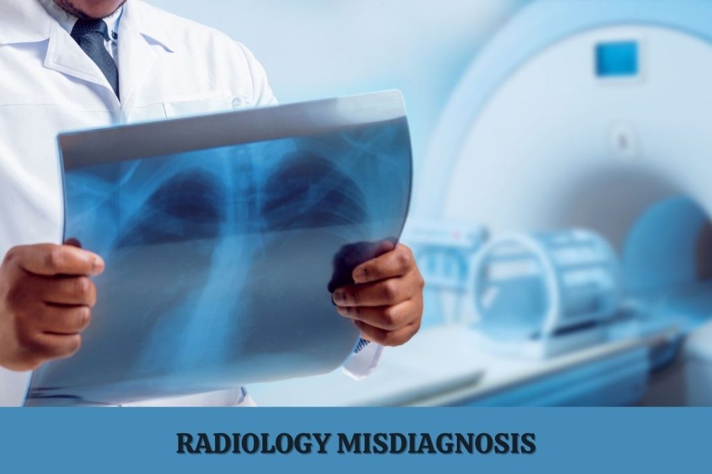 A Radiologist with an imaging study errors in ct scans vs mri scans