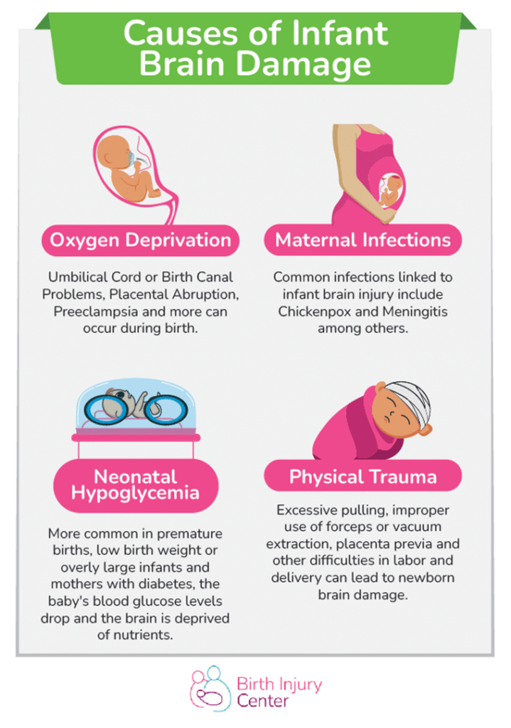 BIRTH INJURY CENTER CAUSES OF INFANT BRAIN DAMAGE 719x1024 1