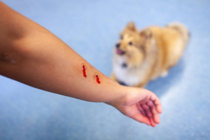 Can You Sue for a Minor Dog Bite AK Blog 420x280 1