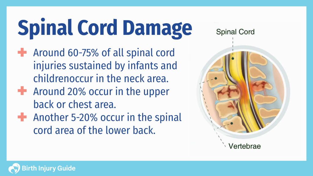 Spinal Cord Damage