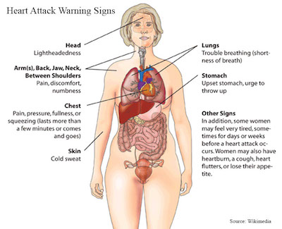 heart attack warning signs women final