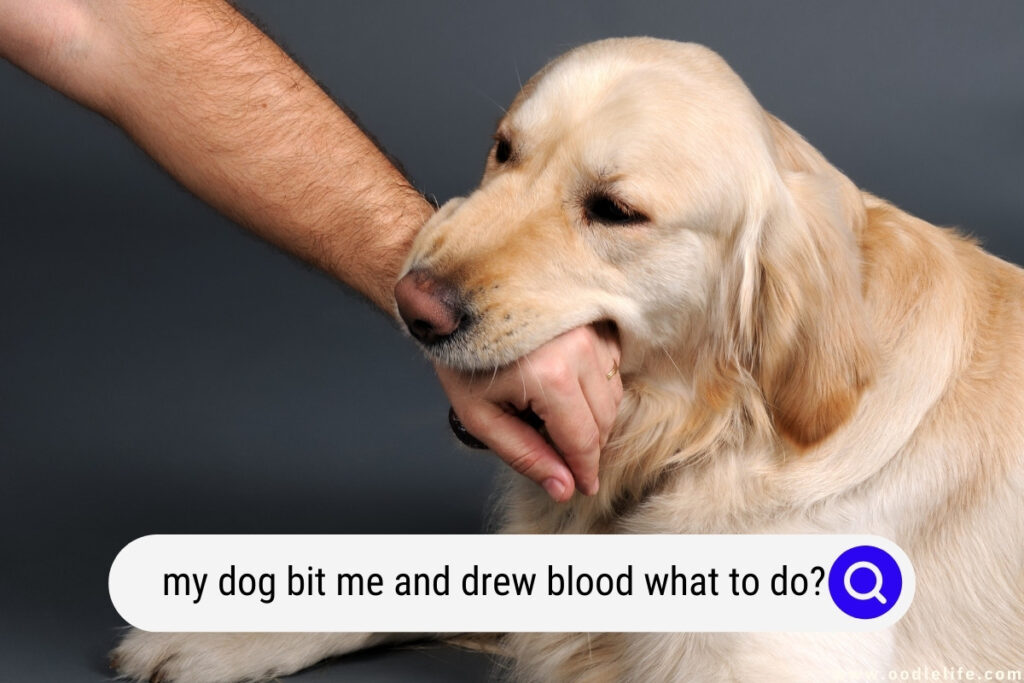 my dog bit me and drew blood 1024x683 1