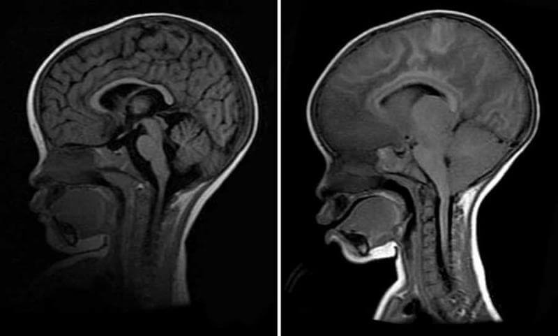 neural imaging bila