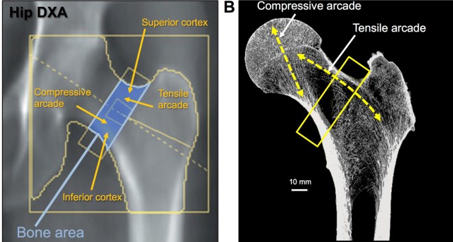 What Is The Frequency Of Dexa Scan Misdiagnosis